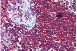 Human Spleen: Formalin-Fixed, Paraffin-Embedded (FFPE) (STIP1 anticorps  (AA 445-544))