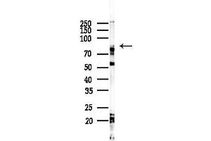 anti-Cyclic Nucleotide Gated Channel beta 3 (CNGB3) (N-Term) antibody