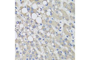 Immunohistochemistry of paraffin-embedded human liver injury using PRODH antibody (ABIN5973448) at dilution of 1/100 (40x lens). (PRODH anticorps)