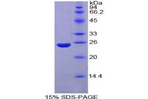SDS-PAGE analysis of Mouse Nucleoporin 160 kDa Protein.