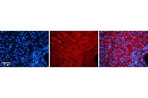 Rabbit Anti-COPS2 Antibody   Formalin Fixed Paraffin Embedded Tissue: Human Liver Tissue Observed Staining: Cytoplasm in hepatocytes Primary Antibody Concentration: 1:100 Other Working Concentrations: N/A Secondary Antibody: Donkey anti-Rabbit-Cy3 Secondary Antibody Concentration: 1:200 Magnification: 20X Exposure Time: 0.