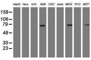 Image no. 2 for anti-Receptor (TNFRSF)-Interacting serine-threonine Kinase 1 (RIPK1) (AA 133-422) antibody (ABIN1490913) (RIPK1 anticorps  (AA 133-422))