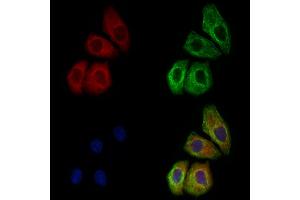 ABIN6259594 and ABIN6274739 staining Hela cells by IF/ICC.