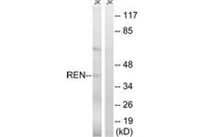 Western blot analysis of extracts from Jurkat cells, using REN Antibody. (Renin anticorps  (AA 207-256))