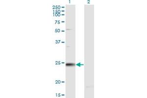 Western Blot analysis of RAB7B expression in transfected 293T cell line by RAB7B monoclonal antibody (M02), clone 1C3.