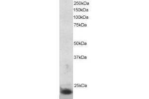 ABIN2560059 staining (5µg/ml) of MOLT-4 lysate (RIPA buffer, 30µg total protein per lane). (SOCS3 anticorps  (C-Term))