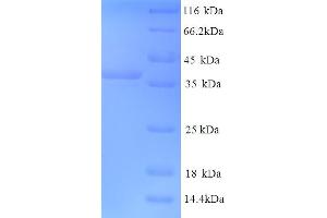 SDS-PAGE (SDS) image for Microtubule-Associated Protein 2 (MAP2) (AA 213-559), (partial) protein (His tag) (ABIN5713628)