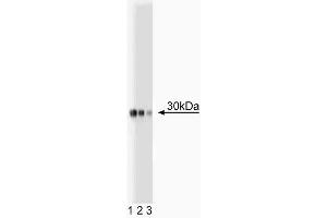 Western blot analysis of Acrp30 on plasma lysate. (ADIPOQ anticorps  (AA 1-247))