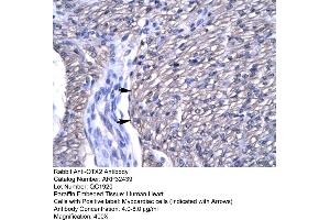Human Heart (OTX2 anticorps  (N-Term))