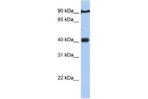 PTOV1 antibody used at 0. (PTOV1 anticorps  (N-Term))