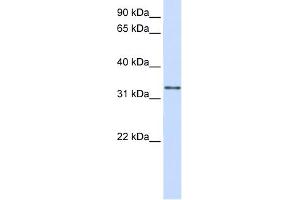 WB Suggested Anti-GPSN2 Antibody Titration:  0. (TECR anticorps  (C-Term))