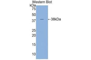 Western blot analysis of the recombinant protein. (Cardiac Troponin T2 anticorps  (AA 1-295))