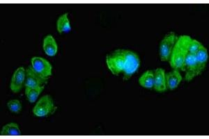 Immunofluorescent analysis of MCF-7 cells using ABIN7162466 at dilution of 1:100 and Alexa Fluor 488-congugated AffiniPure Goat Anti-Rabbit IgG(H+L) (PDRG1 anticorps  (AA 1-133))