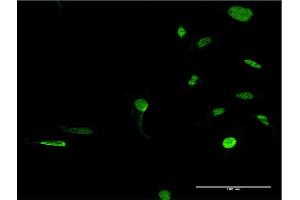 Immunofluorescence of monoclonal antibody to PRKDC on HeLa cell.