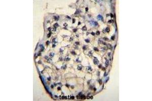 Immunohistochemistry (IHC) image for anti-Outer Dense Fiber of Sperm Tails 3 (ODF3) antibody (ABIN2996385) (ODF3 anticorps)