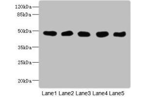 Western Blot All lanes: GCDH antibody at 8 μg/mL Lane 1: Mouse kidney tissue Lane 2: Mouse liver tissue Lane 3: Hela whole cell lysate Lane 4: MCF-7 whole cell lysate Lane 5: LO2 whole cell lysate Secondary Goat polyclonal to rabbit IgG at 1/10000 dilution Predicted band size: 49, 48 kDa Observed band size: 49 kDa (GCDH anticorps  (AA 45-300))