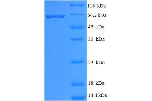 SDS-PAGE (SDS) image for Histone Deacetylase 8 (HDAC8) (AA 1-377), (full length) protein (His-SUMO Tag) (ABIN5709653)