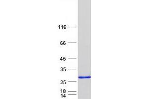 Validation with Western Blot