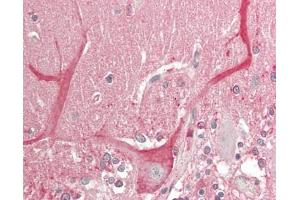 Human Brain, Cerebellum: Formalin-Fixed, Paraffin-Embedded (FFPE).