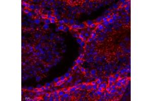 Immunofluorescence of paraffin embedded mouse testis using THNSL2 (ABIN7075893) at dilution of 1: 400 (400x lens)