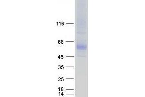 Validation with Western Blot