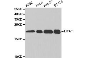 Western blot analysis of extracts of various cell lines, using LITAF antibody (ABIN5973182) at 1/1000 dilution. (LITAF anticorps)