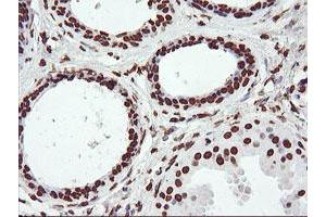 Immunohistochemistry (IHC) image for anti-F-Box Protein 21 (FBXO21) antibody (ABIN1498233) (FBXO21 anticorps)