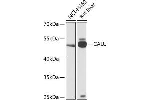 Western blot analysis of extracts of various cell lines, using CALU antibody (ABIN6129532, ABIN6137877, ABIN6137879 and ABIN6216027) at 1:1000 dilution. (CALU anticorps  (AA 20-315))