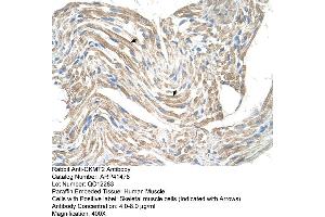 Rabbit Anti-CKMT2 Antibody  Paraffin Embedded Tissue: Human Muscle Cellular Data: Skeletal muscle cells Antibody Concentration: 4.