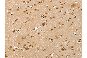 The image on the left is immunohistochemistry of paraffin-embedded Human brain tissue using ABIN7192547(SLTM Antibody) at dilution 1/40, on the right is treated with synthetic peptide. (SLTM anticorps)
