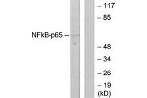 Western blot analysis of extracts from HeLa cells, using NF-kappaB p65 (Ab-536) Antibody. (NF-kB p65 anticorps  (AA 502-551))