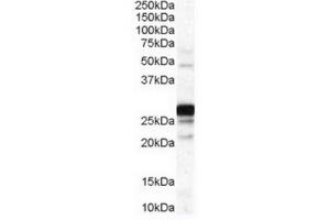 Image no. 1 for anti-Catechol-O-Methyltransferase (COMT) (Internal Region) antibody (ABIN374718) (COMT anticorps  (Internal Region))