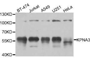 Western blot analysis of extracts of various cell lines, using KPNA3 antibody (ABIN5974559) at 1/1000 dilution. (KPNA3 anticorps)