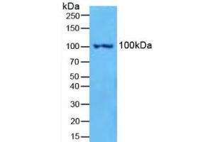Detection of NFkB2 in Mouse Spleen Tissue using Polyclonal Antibody to Nuclear Factor Kappa B2 (NFkB2) (Nuclear Factor kappa B2 (AA 38-343) anticorps)