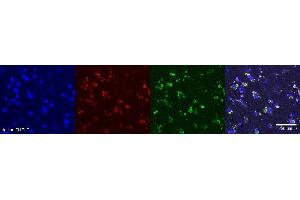 Immunohistochemistry (IHC) image for anti-Oligodendrocytic Myelin Paranodal and Inner Loop Protein (OPALIN) antibody (ABIN7456149) (OPALIN anticorps)