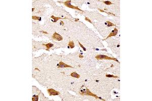 (ABIN6242448 and ABIN6578653) staining RPS27 in human brain tissue sections by Immunohistochemistry (IHC-P - paraformaldehyde-fixed, paraffin-embedded sections).
