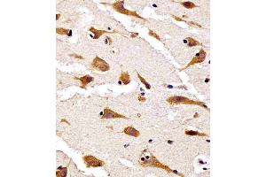 (ABIN6242448 and ABIN6578653) staining RPS27 in human brain tissue sections by Immunohistochemistry (IHC-P - paraformaldehyde-fixed, paraffin-embedded sections). (RPS27 anticorps  (AA 5-37))