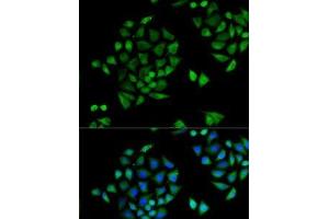 Immunofluorescence analysis of U2OS cells using CYP2C9 Polyclonal Antibody (CYP2C9 anticorps)