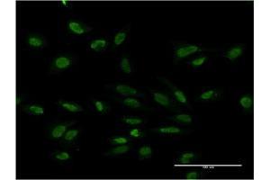 Immunofluorescence of monoclonal antibody to PMS2 on HeLa cell.
