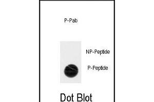 Dot blot analysis of anti-Phospho-ACK1-p Antibody (ABIN389970 and ABIN2839765) on nitrocellulose membrane.
