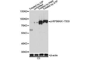 Western blot analysis of extracts of C6 cells, using Phospho-RPS6KA1-T359 antibody.