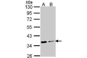WB Image Sample (30 ug of whole cell lysate) A: Molt-4 , B: Raji 10% SDS PAGE antibody diluted at 1:1000