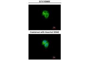ICC/IF Image Immunofluorescence analysis of methanol-fixed Hep G2, using Adenylate kinase 7, antibody at 1:500 dilution. (Adenylate Kinase 7 anticorps)