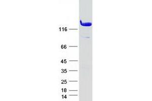 Validation with Western Blot