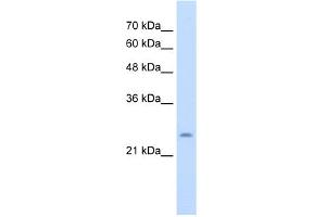 WB Suggested Anti-CHIC1 Antibody Titration:  5. (CHIC1 anticorps  (N-Term))