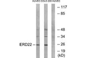 Western blot analysis of extracts from HuvEc/COLO cells, using ERD22 Antibody. (KDELR2 anticorps  (AA 81-130))