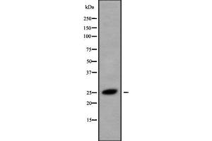 Western blot analysis of CMTM5 using HeLa whole cell lysates