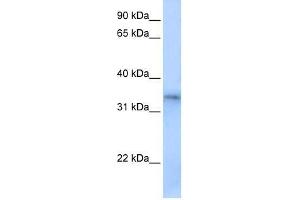 FHL5 antibody used at 0. (FHL5 anticorps  (Middle Region))