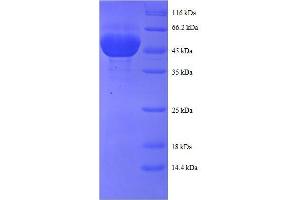 Peroxiredoxin 1 (PRDX1) (AA 1-199), (full length) protein (GST tag)