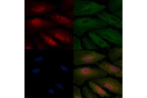 ABIN6256975 and ABIN6275033 staining  cells by IF/ICC. (C1QBP anticorps  (Internal Region))